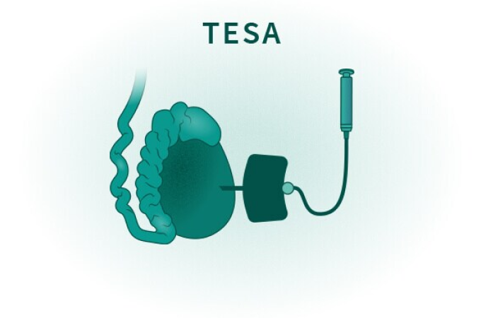 Picture1(76) Medical device labeled TESA: a probe connected by a cord to a square pad, suggesting an electrical stimulation setup.